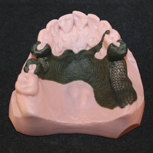 resina para impresora 3D de polímero / para odontología