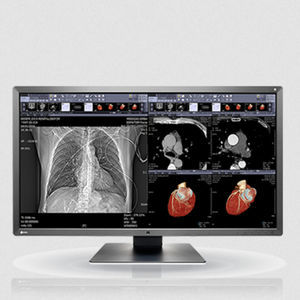 monitor LCD 1