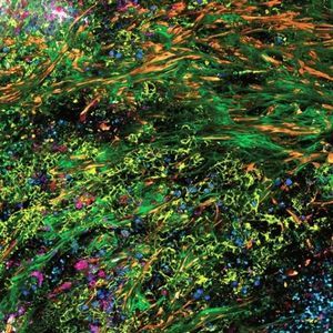microscopio óptico