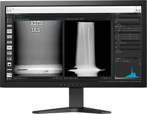 software visualización de imagen de rayos X