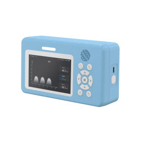 monitor de control de la calidad del aire de CO2 1