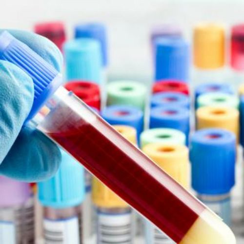 Aditivo para la industria farmacéutica - Celpure® - Imerys Ceramics  - de diatomeas / de alta pureza