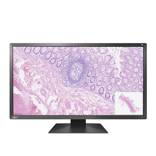Monitor LCD - PX3150 - EIZO NANAO - retroiluminación LED / de visualización / para el sector médico