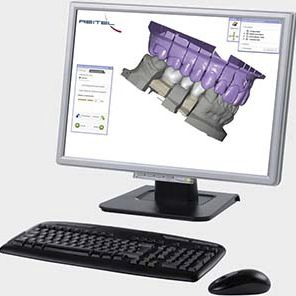 Software de interfaz - exocad  - Reitel - de diseño / de planificación / para odontología