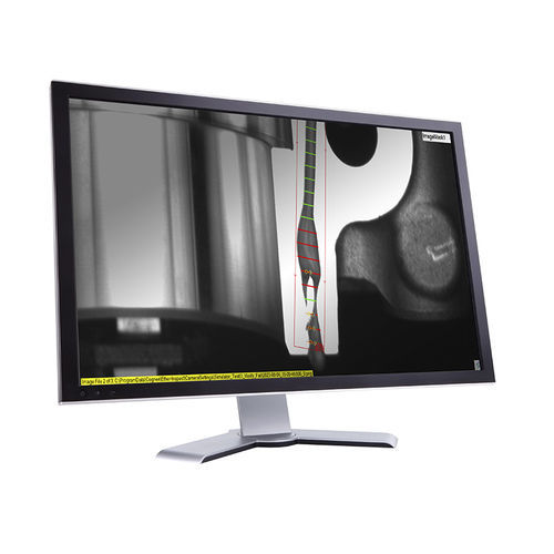 Software de medición - Cognex Corporation - de desarollo / embarcado / de aprendizaje profundo