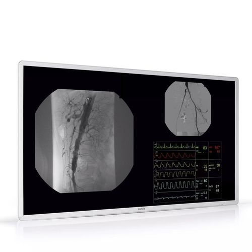 Visualizador IPS - MDAC‑8355 - Barco - de alta definición / UHD / 55"