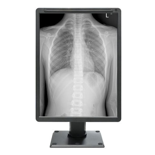 Panel de visualización médico - MDC-G2201 - ZRT Technology - monocromo / 21.3" / HDMI