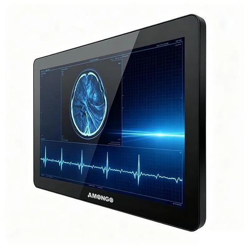 Monitor con pantalla táctil - AMG-15OPTD01G1 - AMONGO Display Technology(ShenZhen)Co.,LTD - retroiluminación LED / para el sector médico / 15,6"
