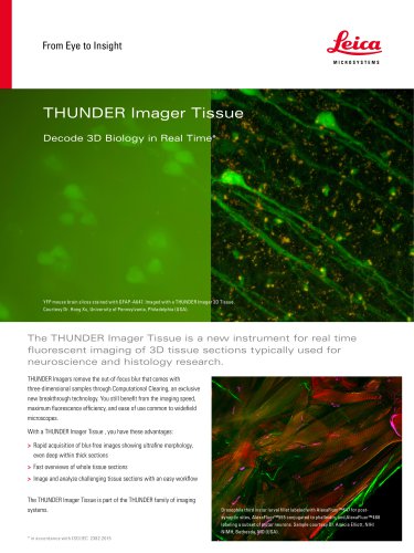 THUNDER Imager Tissue